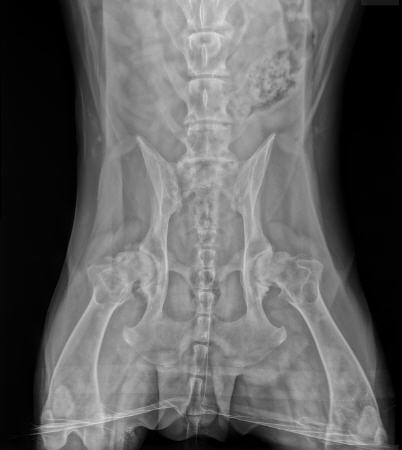 Radiograph showing severe hip dysplasia