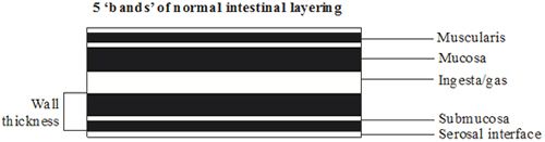 Figure 1. Normal intestinal layering.