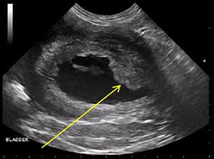 Ultrasound image of a transitional cell carcinoma in a dog's bladder neck. (Photo credit: DVMSound)