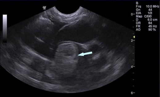 X-ray showing a large clot in the left atrium of a cat with saddle thrombus