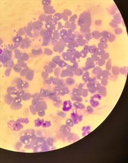 Image of Babesia organisms under a microscope