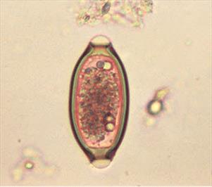 whipworm-egg-under-microscope