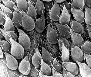 bőrbetegségek és paraziták paraziták kerekférgek pinworm
