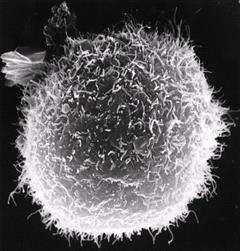 A macrophage cell as seen on a scanning electron microscope.