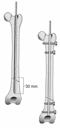 Figure 10.