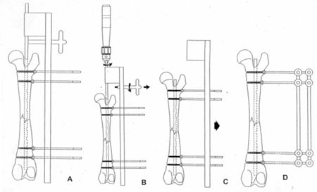 Figure 14.