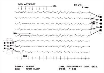 Clinical Electroencephalography in Dogs (1999) - NeuroVet - VIN