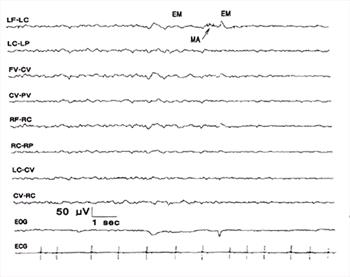 Figure 11.