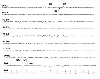 Figure 11.