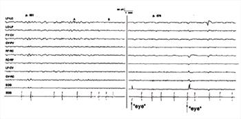 Figure 13.