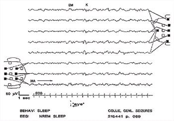 Clinical Electroencephalography in Dogs (1999) - NeuroVet - VIN