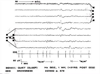 Figure 17.