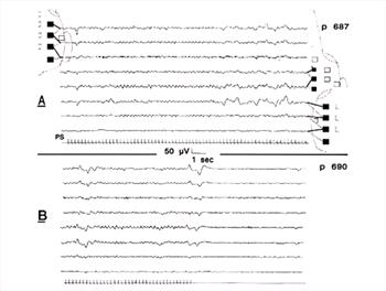 Figure 18.