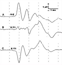 Figure 19.