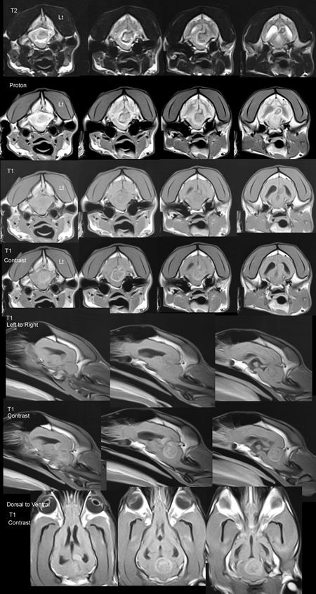 Selected views from Magnetic Resonance Imaging (MRI)