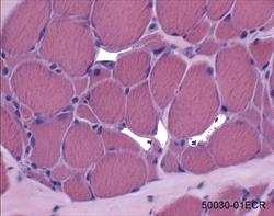 Extensor carpi radialis muscle.