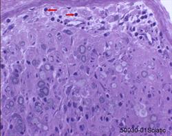 Sciatic nerve, plastic embedded nerve biopsy section, toluidine blue stain.