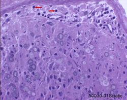 Sciatic nerve, plastic embedded nerve biopsy section, toluidine blue stain.