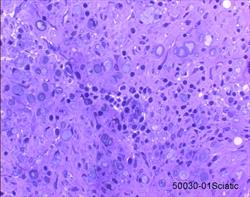 Sciatic nerve, plastic embedded nerve biopsy section, toluidine blue stain.