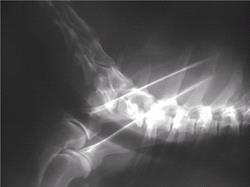 Lateral cervicothoracic radiograph