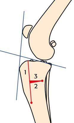 Figure 1a