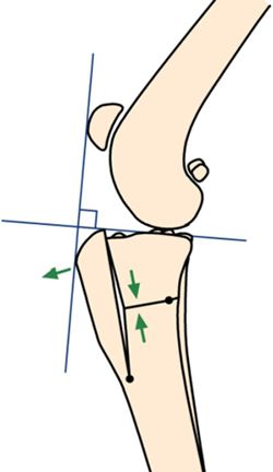 Figure 1b