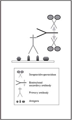 Figure 3. Labelled streptavidin-biotin (LSAB) immunohistochemistry.