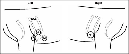 Figure 1. The PMI of the various heart sounds in the dog.