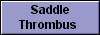  Saddle
Thrombus 